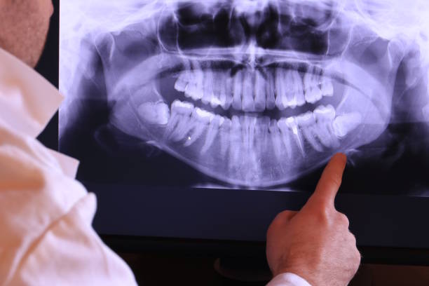 Best Broken Tooth Emergency  in South Bend, WA