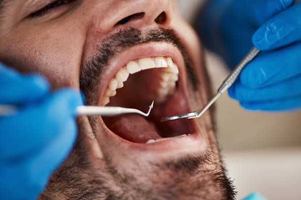 Best Walk-In Dentist Near Me  in South Bend, WA